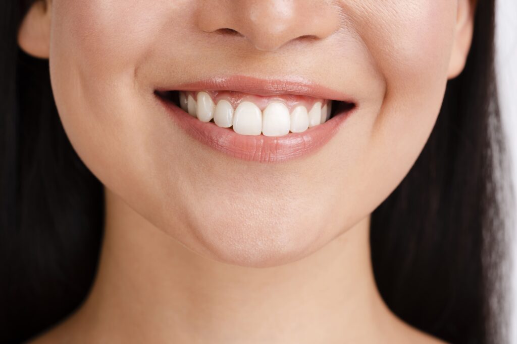 teeth whitening treatment