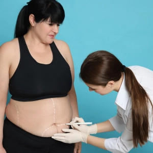 Liposuction Calicut